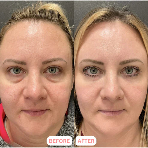 Vetrono™ Lymphatic Contour Face Brush