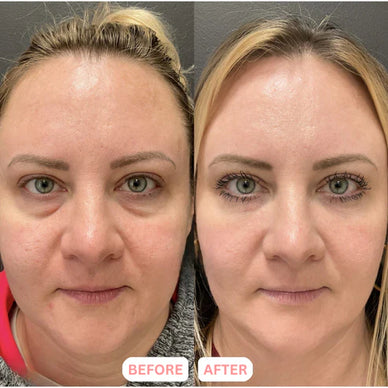 Achieve a Radiant, Sculpted Glow Effortlessly!